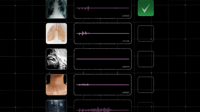Tuberculosis Screening